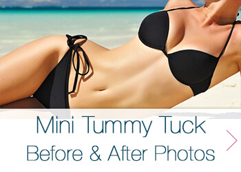 the torso of a woman with a flat stomach wearing a black bikini laying on a beach