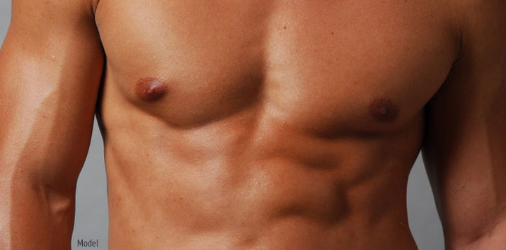 Male Breast Reduction
