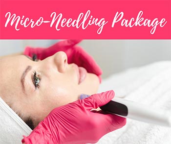 woman receiving a microneedling treatment