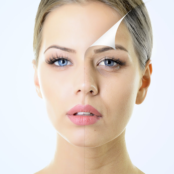 Before and after side by side of a chemical peel treatment