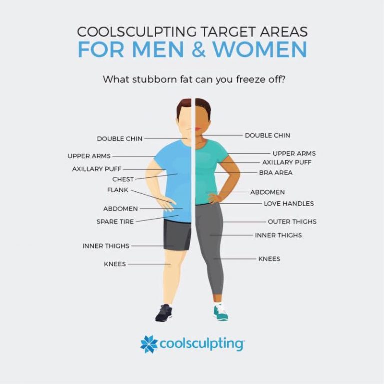 Infographic showing most popular cool sculpting target areas for men vs women