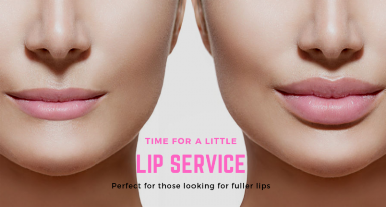 Before and after photo of lip plumping service